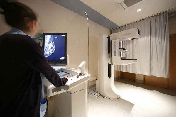 mamografía digital